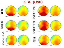 前世療法の脳波データ